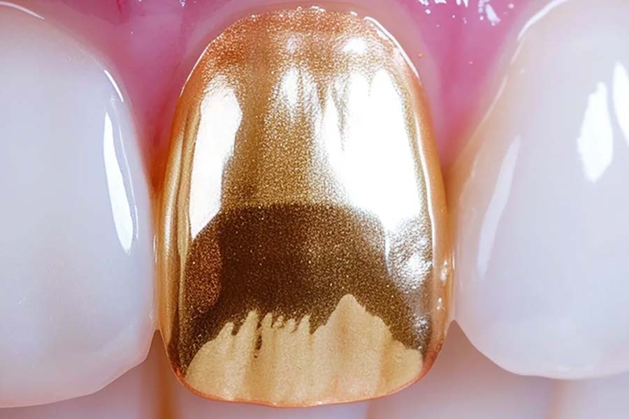 World’s expensive human tooth worth 30 lakh rupees