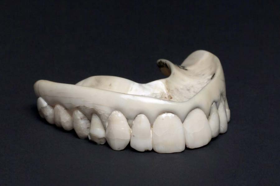 World’s expensive human tooth worth 30 lakh rupees