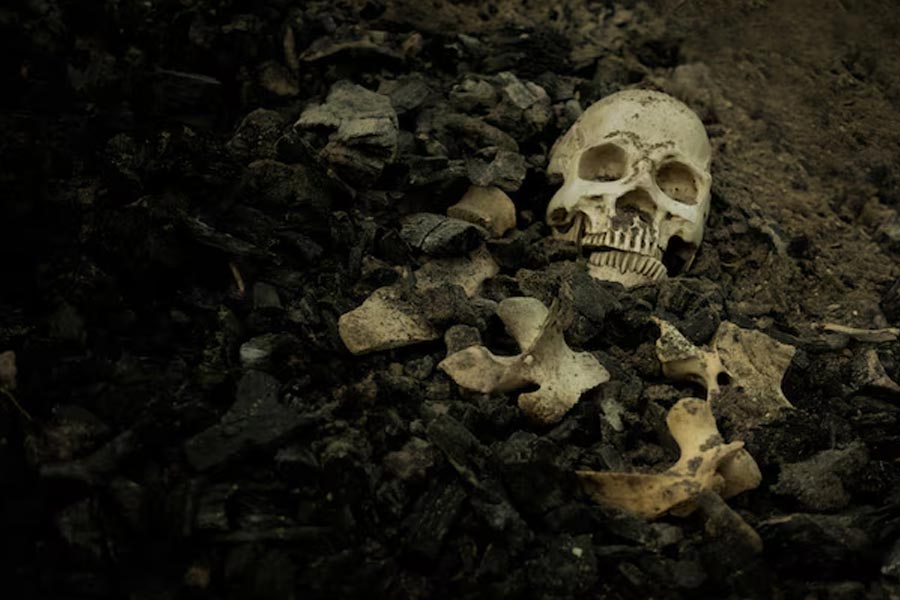 Human skull and bones found in Beleghata ID hospital on friday dgtl