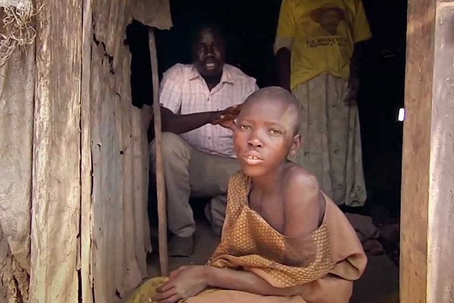 Uganda's district has been affected by a mysterious illness named dinga dinga 