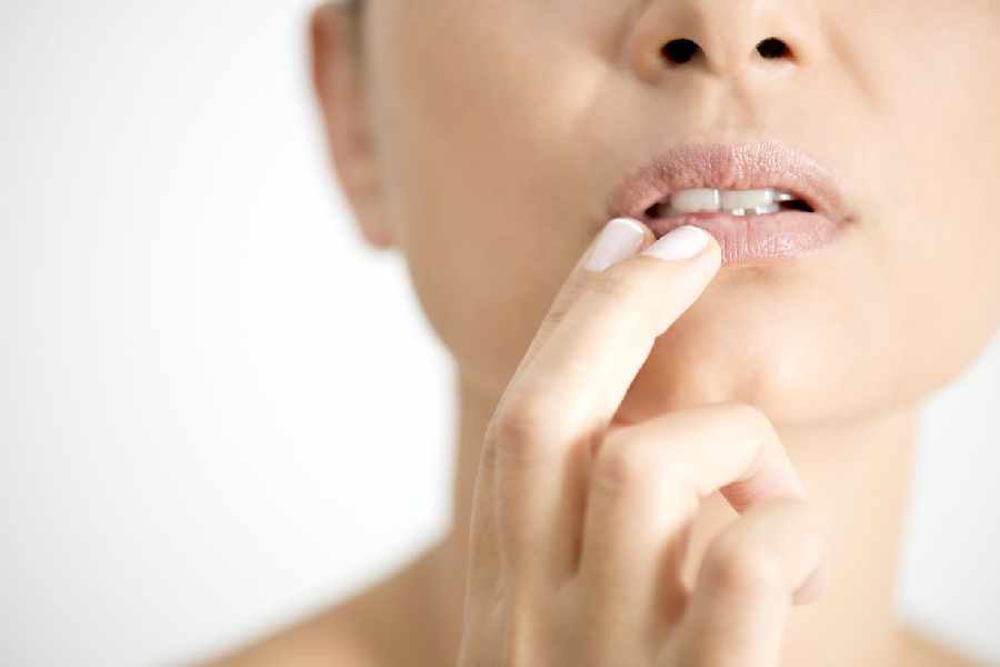 Five causes for dark lips.