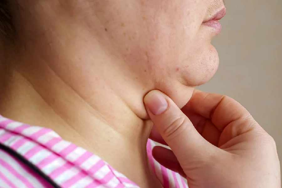 Simple exercises to get rid of double chin problem.