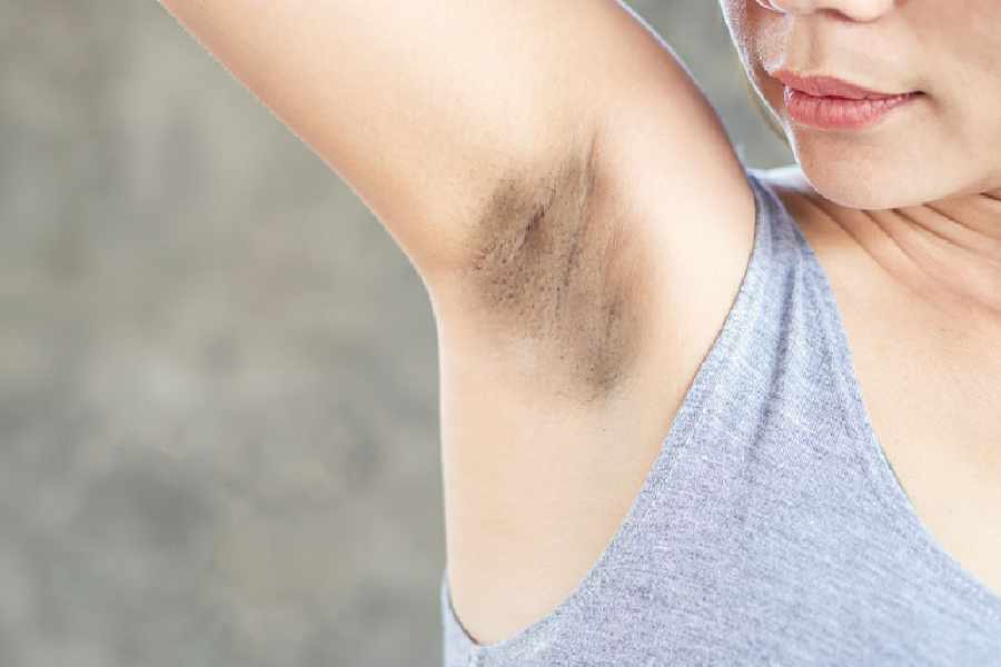 Try these home remedies to remove dark underarm