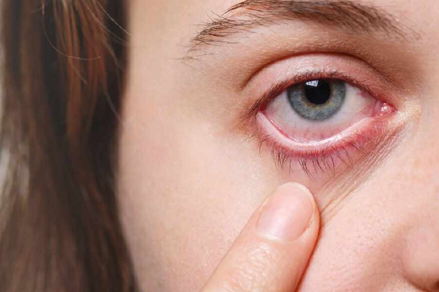 Five symptoms of Diabetic Retinopathy that you should not avoid