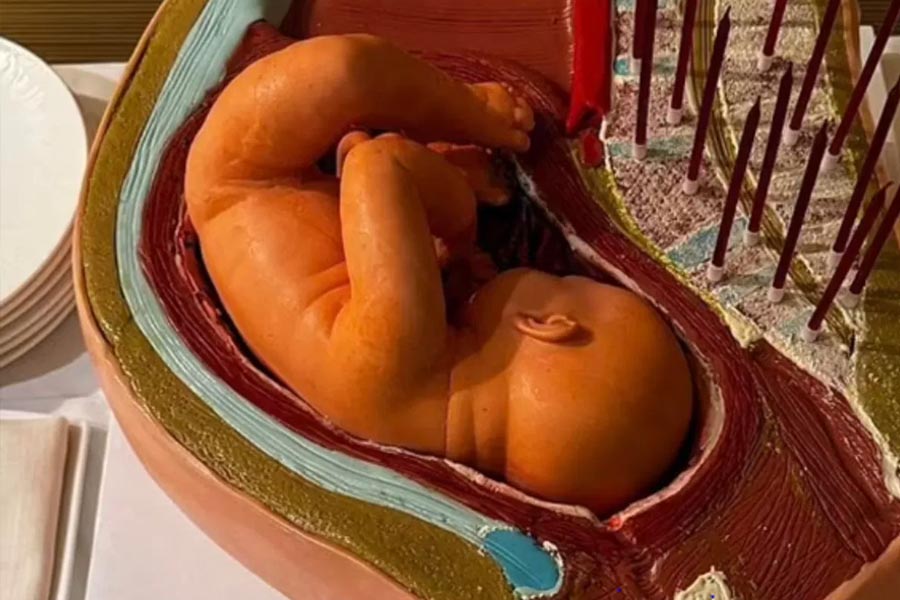Man gives pregnant girlfriend bizarre cake resembling unborn child on birthday