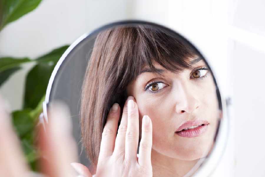 Signs on your face that can indicate vitamin deficiency