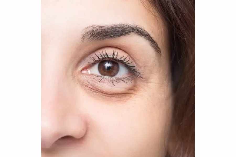 Beauty benefits of having bottle gourd or lau juice