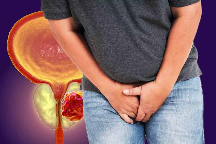 মূত্রথলির নীচের দিকে এই প্রস্টেটের অবস্থান। দেখতে অনেকটা আখরোটের মতো। চিকিৎসকেরা বলছেন, এই গ্রন্থিটি বয়সের সঙ্গে সঙ্গে আকারে বেড়ে যেতে পারে। 