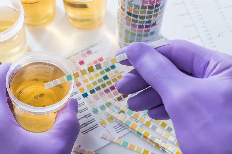 What makes urine yellow? Scientists have found the answer.