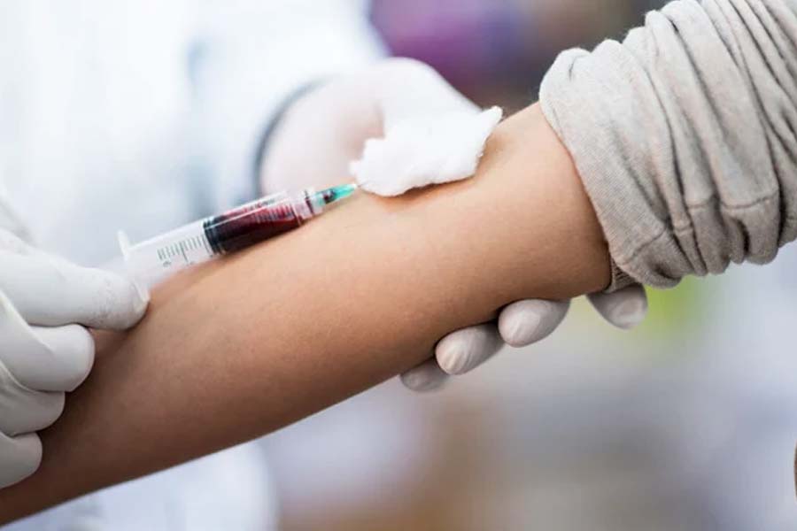 অভিযোগ, বাড়ির দোরগোড়ায় চিকিৎসা পৌঁছে দেওয়ার আড়ালে নাকি চলছে হাজার হাজার কোটির টাকার খেলা! ভূতুড়ে রোগী থেকে ভুয়ো স্বাস্থ্যপরীক্ষা— অনেক কিছুই সেই খেলার অঙ্গ।