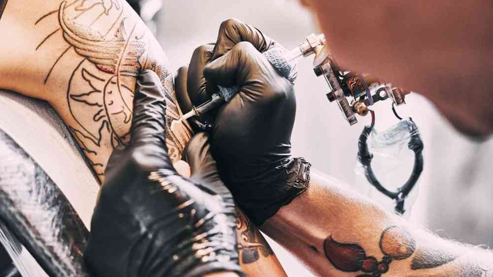 Things to consider while tattoo removal.
