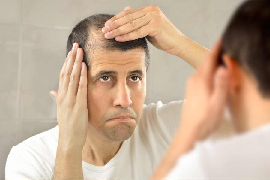 Worst foods to avoid if you\\\'re suffering from hair loss.