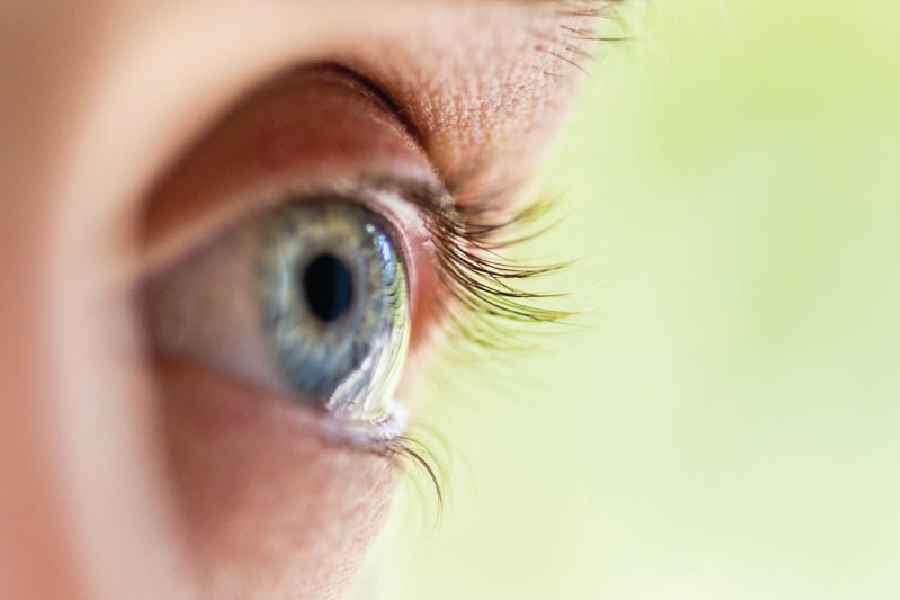 What are the symptoms of cataract and how to prevent.