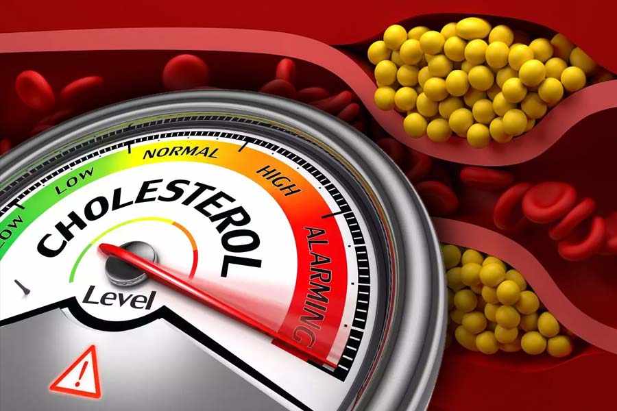 Foods not to eat if you have high cholesterol