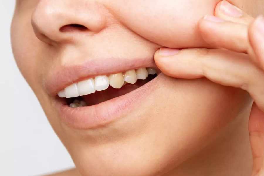Five teeth whitening tips that always work.
