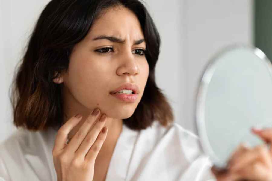 Tips on combating the unwanted Skin Stickiness during Monsoon