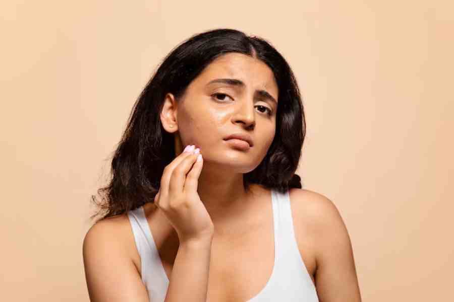 How unhealthy lifestyle can cause oily skin and breakout