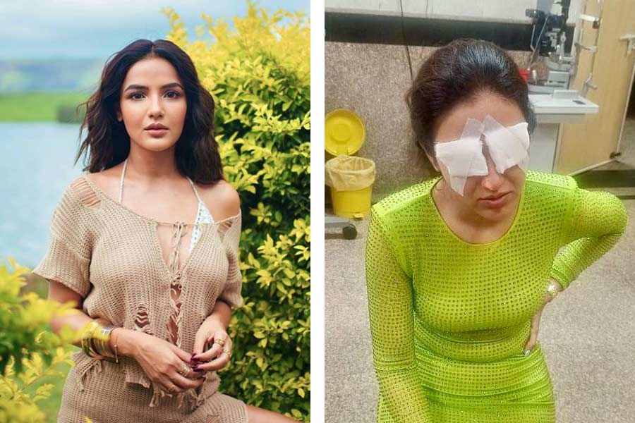 Jasmin Bhasin could not see anything as she suffered corneal damage