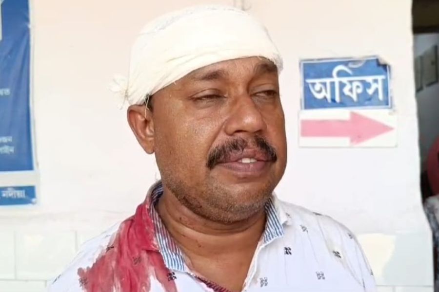 Shantipur College Professor injured