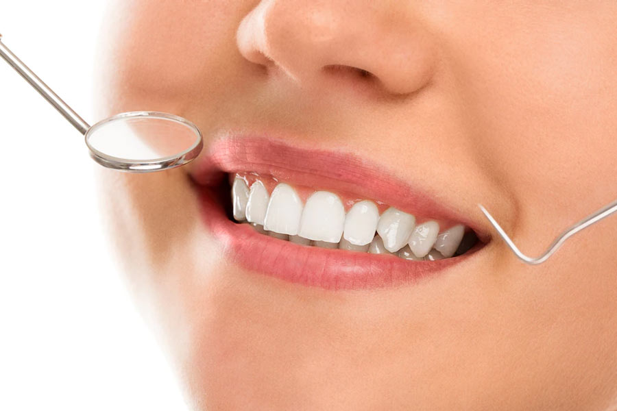 How to whiten Teeth at home, here are the tips