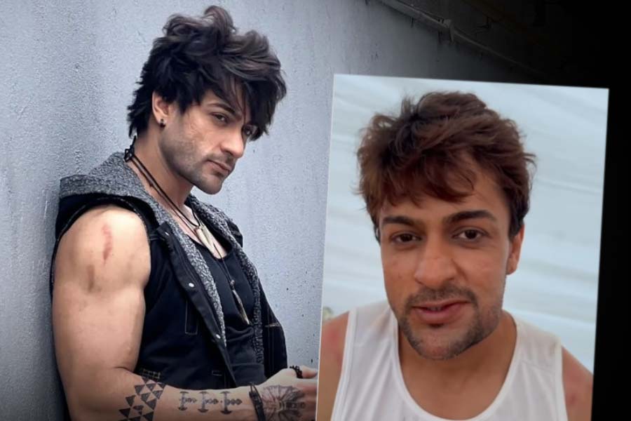 Actor Shalin Bhanot shares a video and it shows he is badly injured