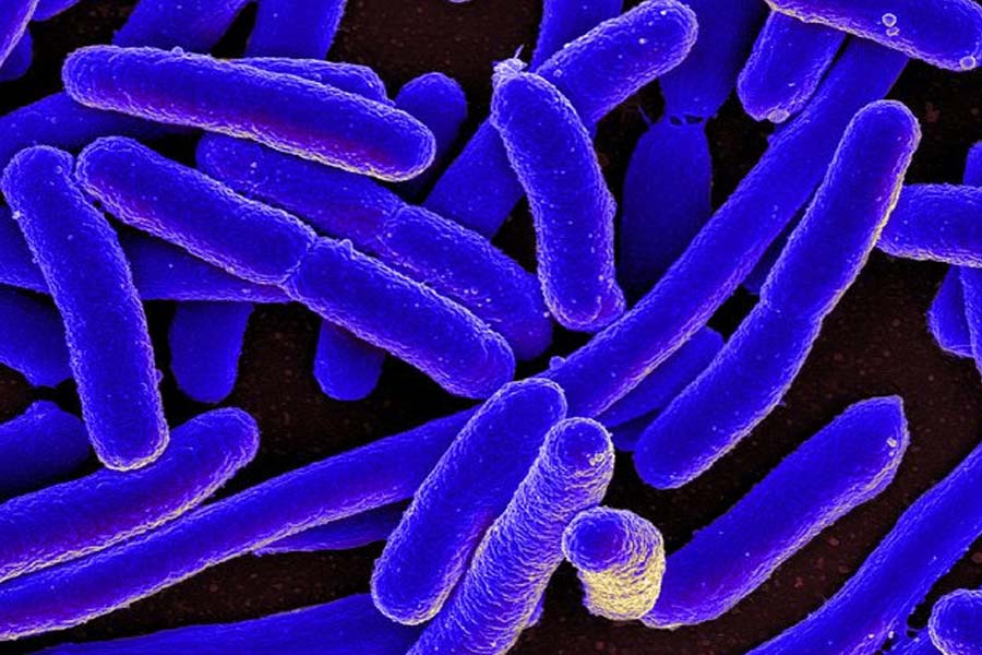 All you need to know about Super Bug and how much it can affect scientists in International Space Station 