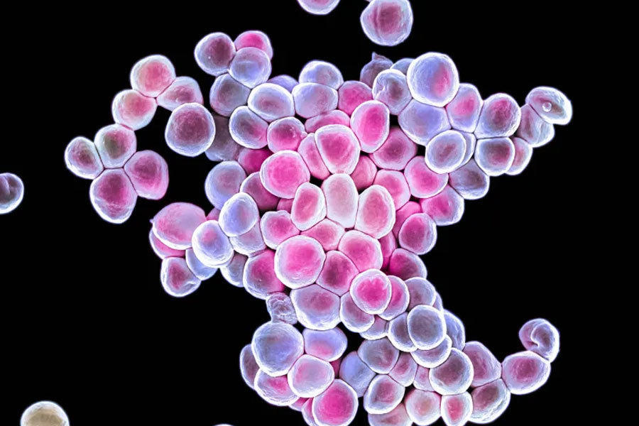 All you need to know about Super Bug and how much it can affect scientists in International Space Station 