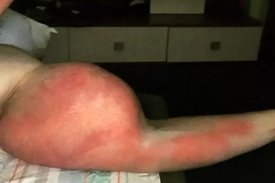 কিরিল টেরেশিন রাশিয়ার বাসিন্দা। তাঁকে ‘রুশ পপাই’ বলা হয়। পপাই এক কার্টুন চরিত্র, যার হাতের পেশিগুলো (বাইসেপ) অস্বাভাবিক রকমের স্ফীত। কিরিলেরও তা-ই। সে কারণেই তাঁকে ‘রুশ পপাই’ বলা হয়।