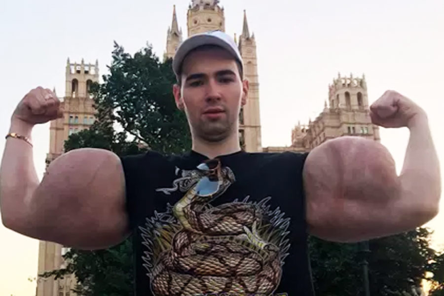 এর পর একের পর এক অস্ত্রোপচার, চিকিৎসার প্রক্রিয়া শুরু হয়। কিরিলের হাতে অস্ত্রোপচার করে প্রচুর পরিমাণ জেলি বার করা হয়।