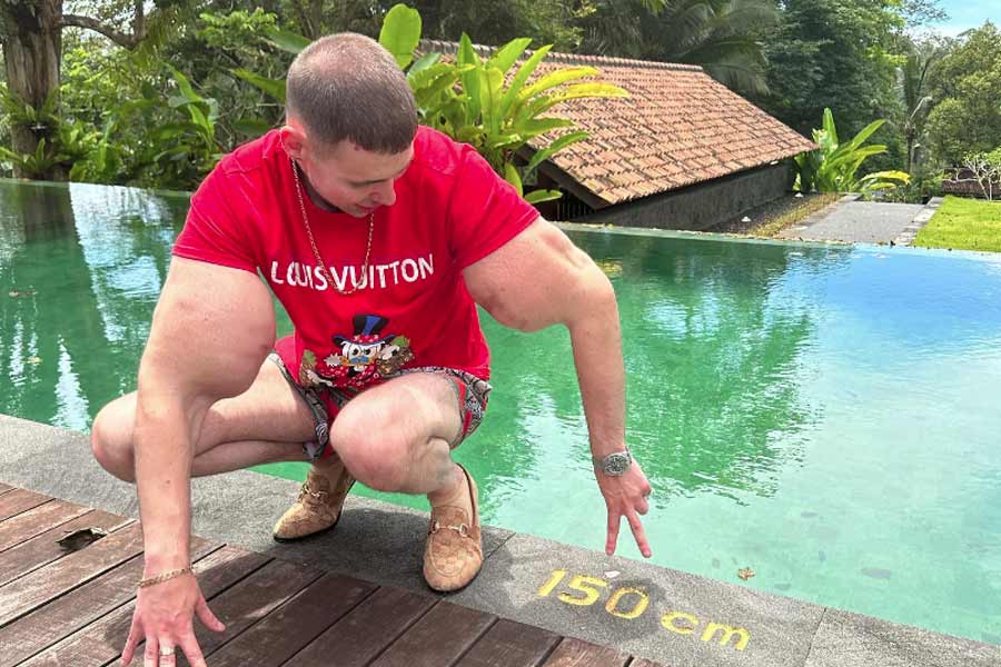 কেন শরীর নিয়ে এতটা পরীক্ষা-নিরীক্ষা করেছিলেন কিরিল? কেন হাতে তেল ভরা ইঞ্জেকশন নিয়েছিলেন? নিজেই জানিয়েছেন সে কথা। তাঁর কথায়, ‘‘সুন্দরী মহিলাদের আকর্ষণ করার চেষ্টা করেছিলাম। আমার মনে হয়েছিল, আমার মতো সাধারণ চেহারার কাউকে মহিলারা পছন্দ করবেন না। সে কারণেই ও সব করা।’’