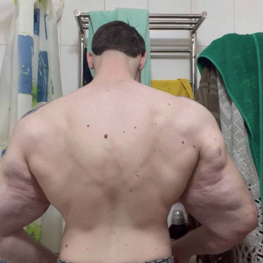 এ সব ভেবেই বাইসেপ স্ফীত করার সিদ্ধান্ত নিয়েছিলেন। সমাজমাধ্যমে একটি ভিডিয়ো পোস্ট করে তিনি জানান, প্রথমে উদ্ভিজ্জ তেল ফুটিয়ে শরীরে ইঞ্জেকশন দিতে শুরু করেন। প্রতি দিন ৫ মিলিলিটার করে শরীরে ওই তেল প্রবেশ করাতেন তিনি।