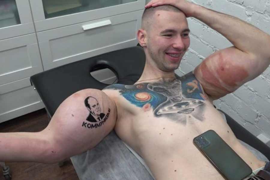 ছ’মাসের মধ্যে তিনি খেয়াল করেন, হাতে পেশিগুলো স্ফীত হয়েছে। ওজনও বেড়েছে। কিন্তু তার পরেই শুরু হয় সমস্যা। চিকিৎসকেরা জানান, এই পেট্রোলিয়াম জেলি তাঁর কিডনির ক্ষতি করতে পারত। তাঁর প্রাণও যেতে পারত।