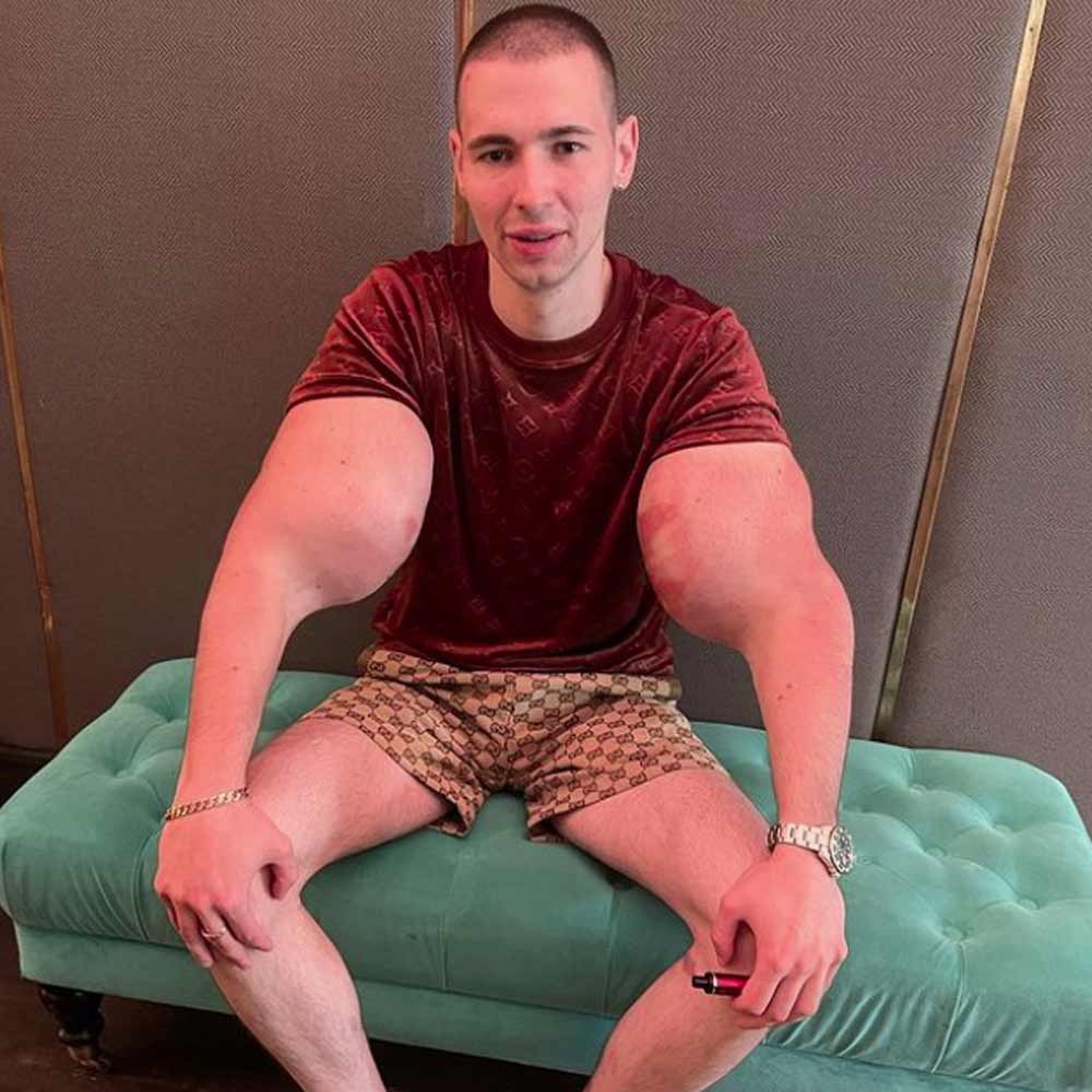 এত কিছুর পরেও দমেননি কিরিল। এর পর পরীক্ষা-নিরীক্ষা শুরু করেন মুখের উপর। মুখের অস্ত্রোপচার করান তিনি। খরচ করেন ১৫ হাজার আমেরিকান ডলার। ভারতীয় মুদ্রায় প্রায় ১২ লক্ষ টাকা।