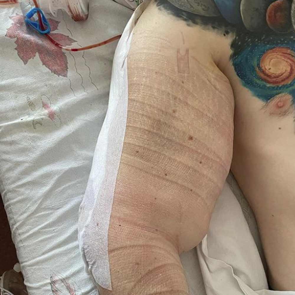 তার ফলও হয় উল্টো। কিরিল জানান, এত খরচ করে এখন তাঁকে ‘জোকার’-এর মতো লাগছে। যদিও সমাজমাধ্যমে কিরিলের অনুগামীরা উদ্বিগ্ন তাঁর শরীর নিয়ে। অদ্ভুত খেয়ালের জন্য এই বয়সে প্রাণ হারাতে পারতেন! যদিও কিরিল রয়েছেন আপন খেয়ালে। অনুগামীরা উদ্বেগে, আবার কী করে বসেন ‘পপাই’! ছবি: সংগৃহীত, ইনস্টাগ্রাম থেকে।