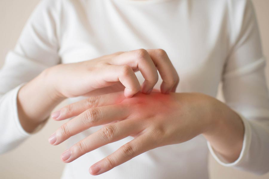 All you need to know about the relation between itching and diabetes