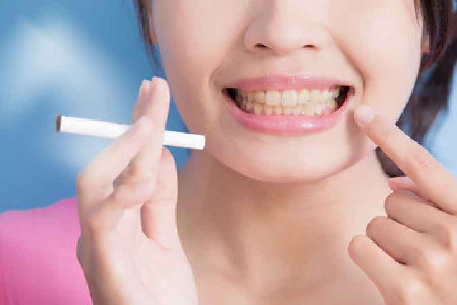 Useful oral care tips for smokers and ex-smokers