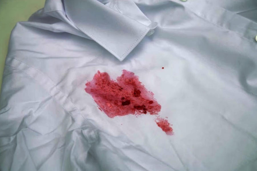 Five easy remedies to remove stubborn stains from clothes