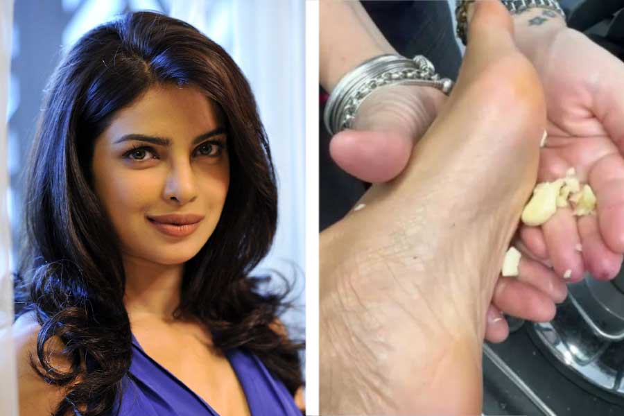 What exactly happens if you rub garlic on feet just like Bollywood actor Priyanka Chopra
