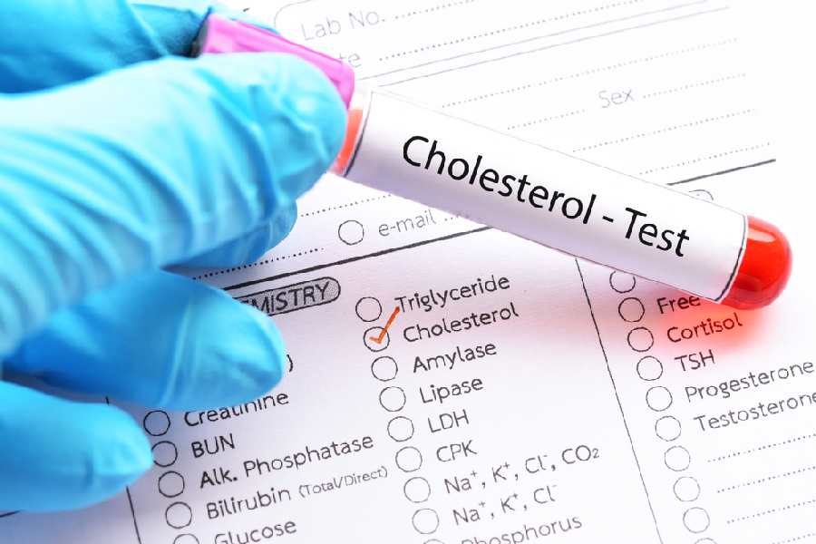 How to manage high cholesterol level