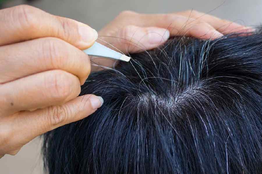 Should you pluck your white hair or not