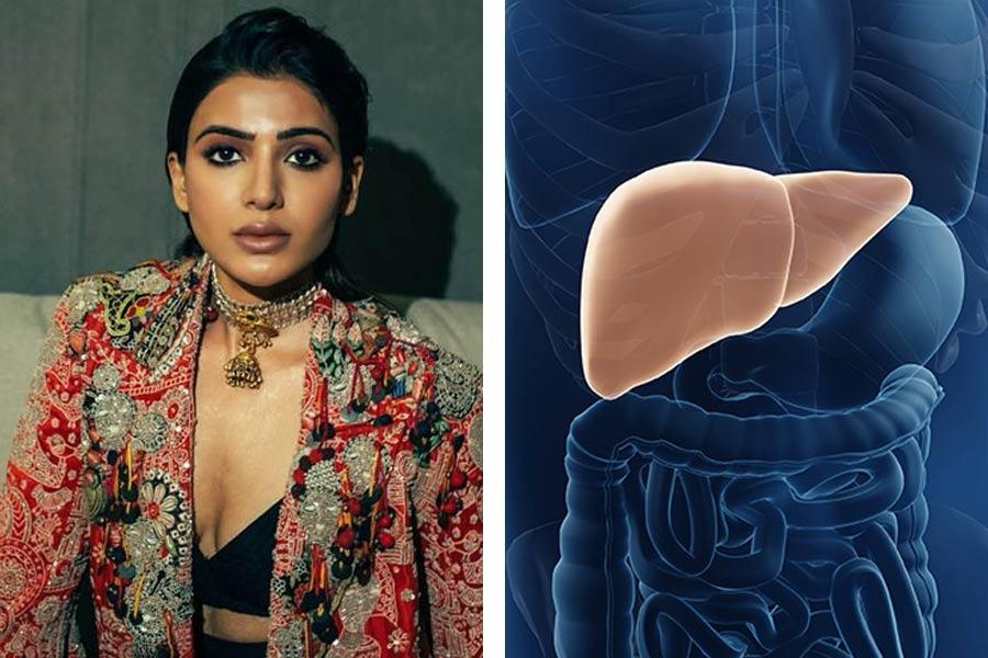 Actress Samantha Ruth Prabhu slammed for misleading fans on her health podcast