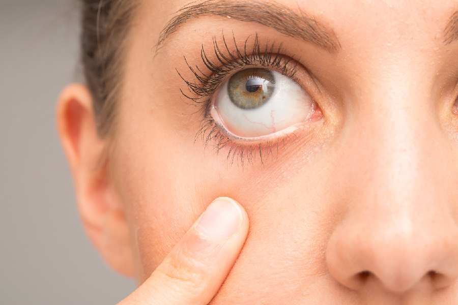 Lifestyle changes to improve your eye health