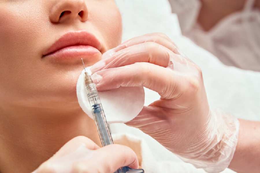 All you need to know about Botox and its effects