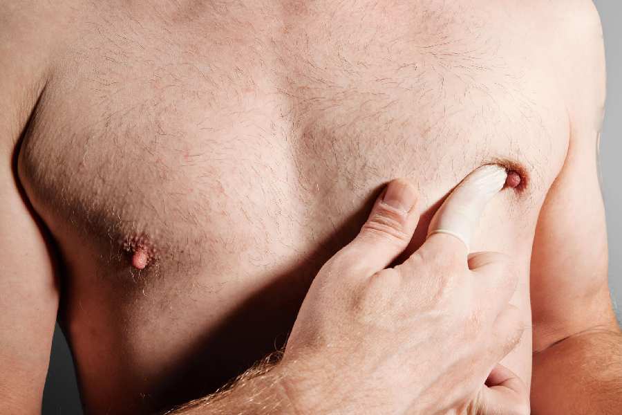 Step by step guide for performing self-breast exam for cancer prevention