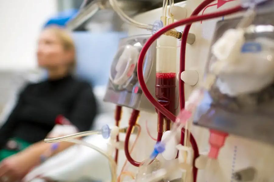 First Person to receive Pig kidney transplant dies after two month