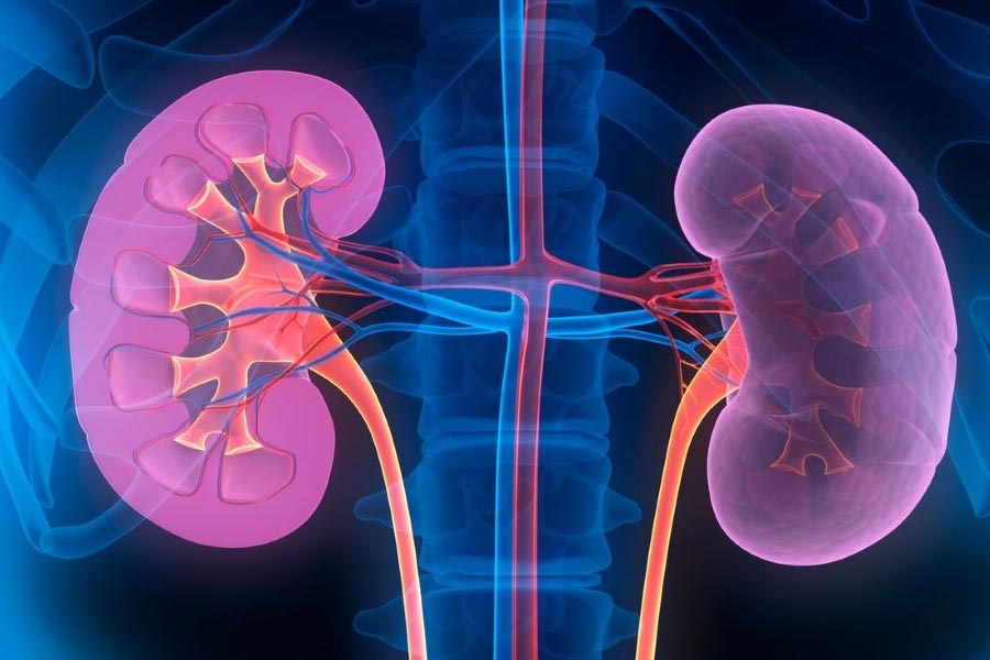 First Person to receive Pig kidney transplant dies after two month