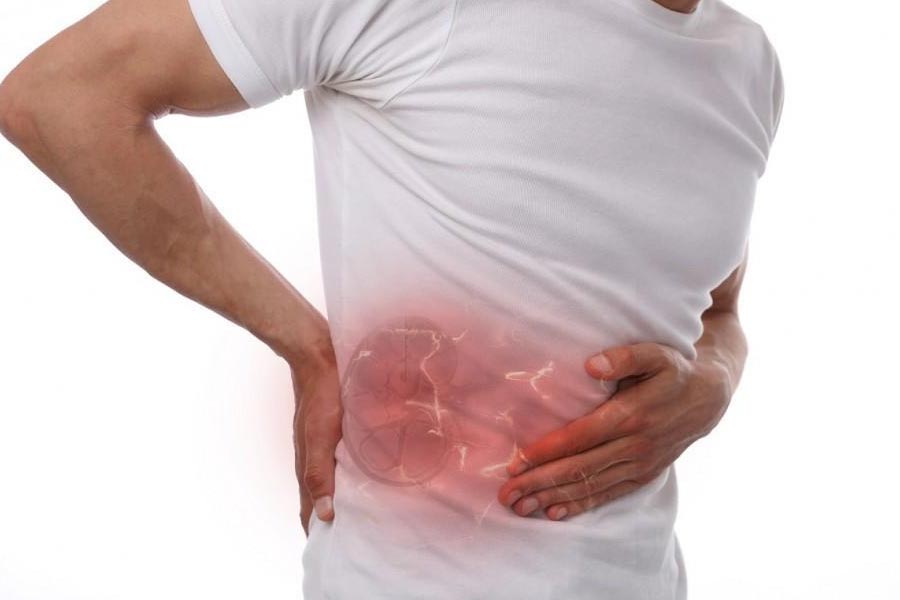 First Person to receive Pig kidney transplant dies after two month