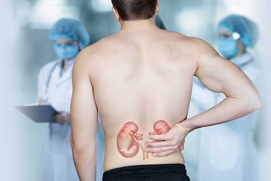 First Person to receive Pig kidney transplant dies after two month