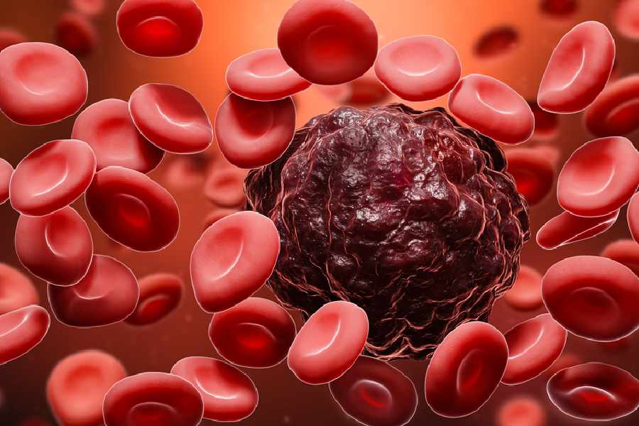 What is Chronic Myeloid Leukemia and how to deal with that problem