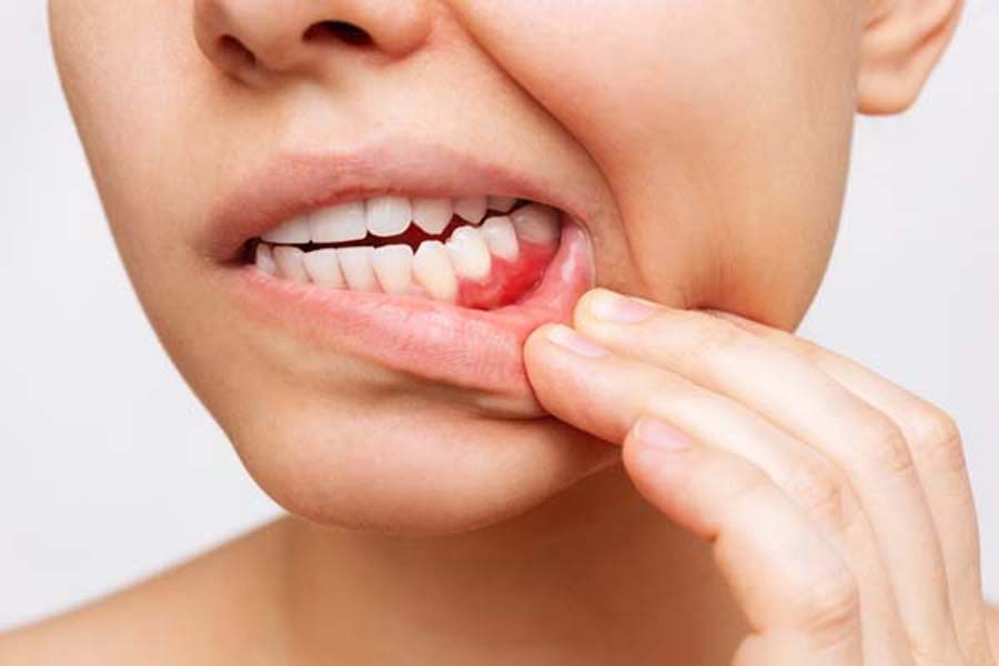 Why poor oral health is a problem for people with Diabetes